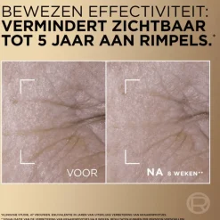 Best L'Oréal Paris L’Oréal Paris Age Perfect Anti-Aging Serum Le Duo 30 ML