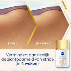 Outlet NIVEA Luminous630 Anti-Striae Lichaamsolie-serum 100 ML