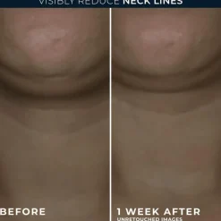 Outlet RoC Derm Correxion Contour Cream 50 ML