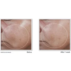 Outlet RoC Derm Correxion Firming Serum Stick