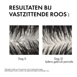 Best Vichy Dercos Anti-Roos Shampoo 200 ML