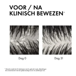 New Vichy Dercos Anti-Roos-2-In-1-Shampoo + Conditioner 200 ML