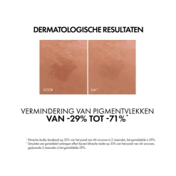 Hot Vichy Liftactiv B3 Anti-Pigmentvlekken Serum 30 ML